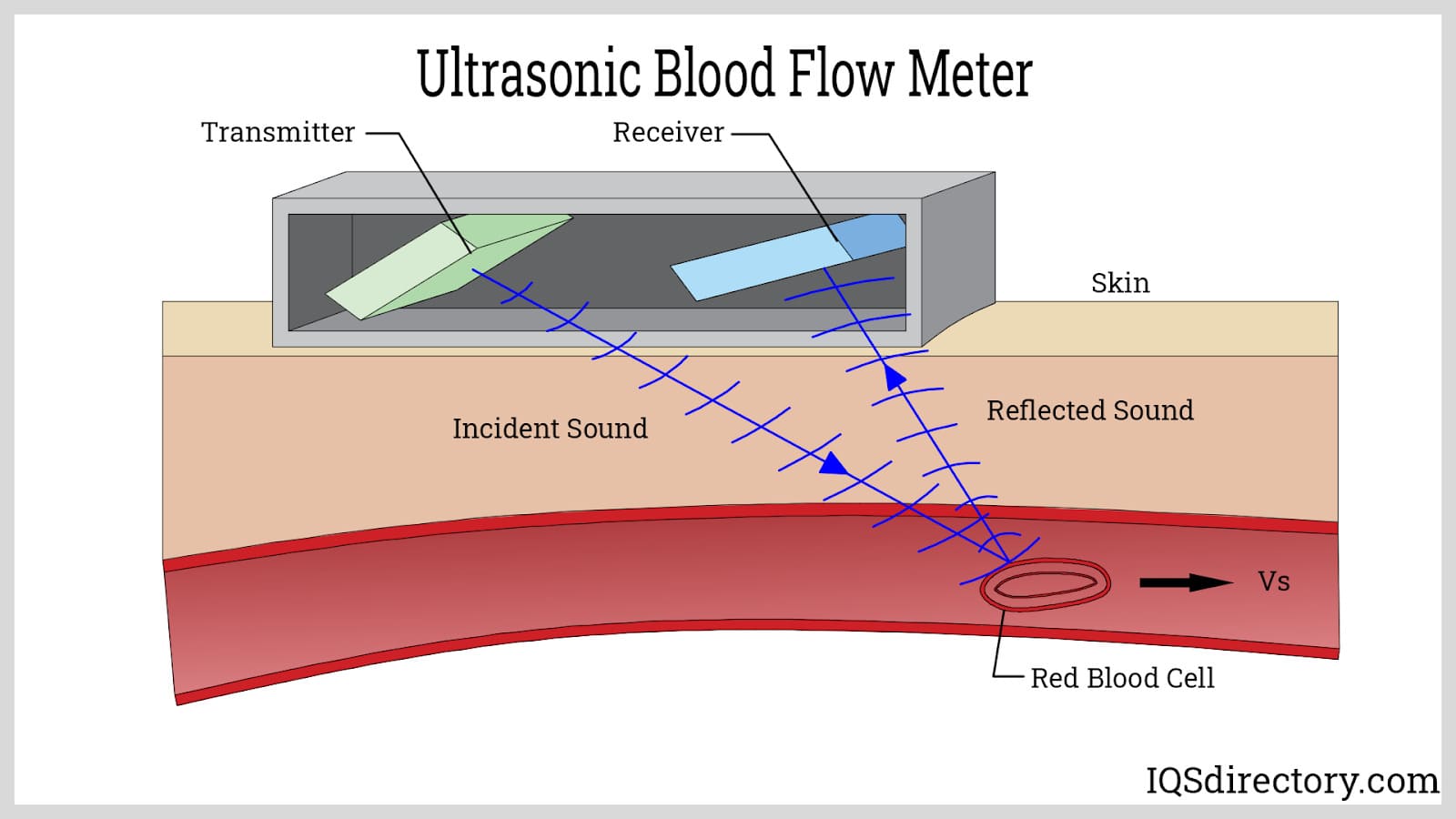 Ultrasonic Blood Flow Meter