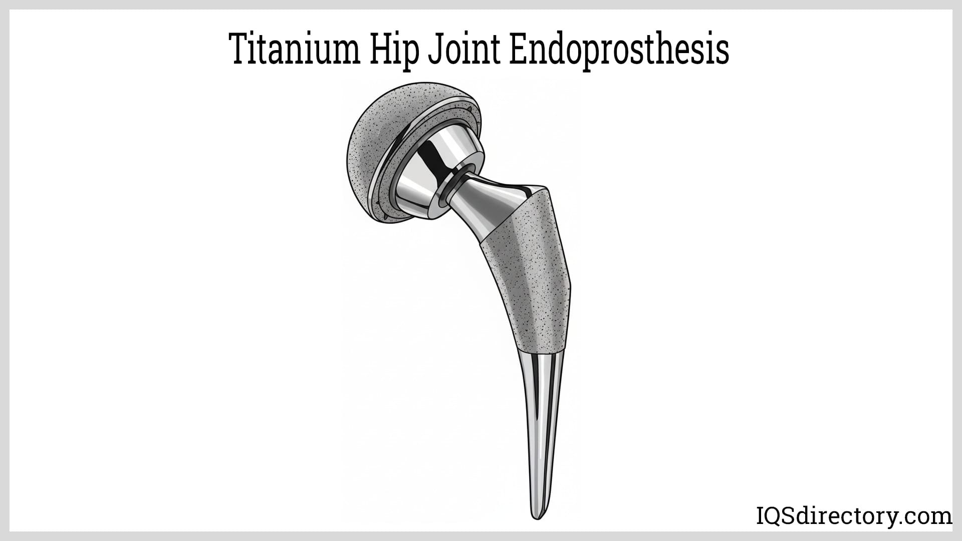 Titanium Hip Joint Endoprosthesis